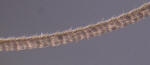 Ciliate antennae of Spaelotis bicava.