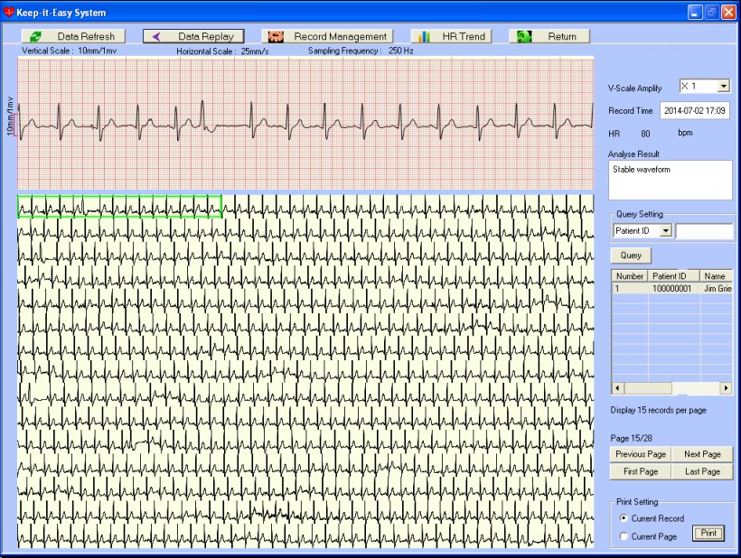 Comparison Of Handheld 1-lead ECG/EKG Recorders