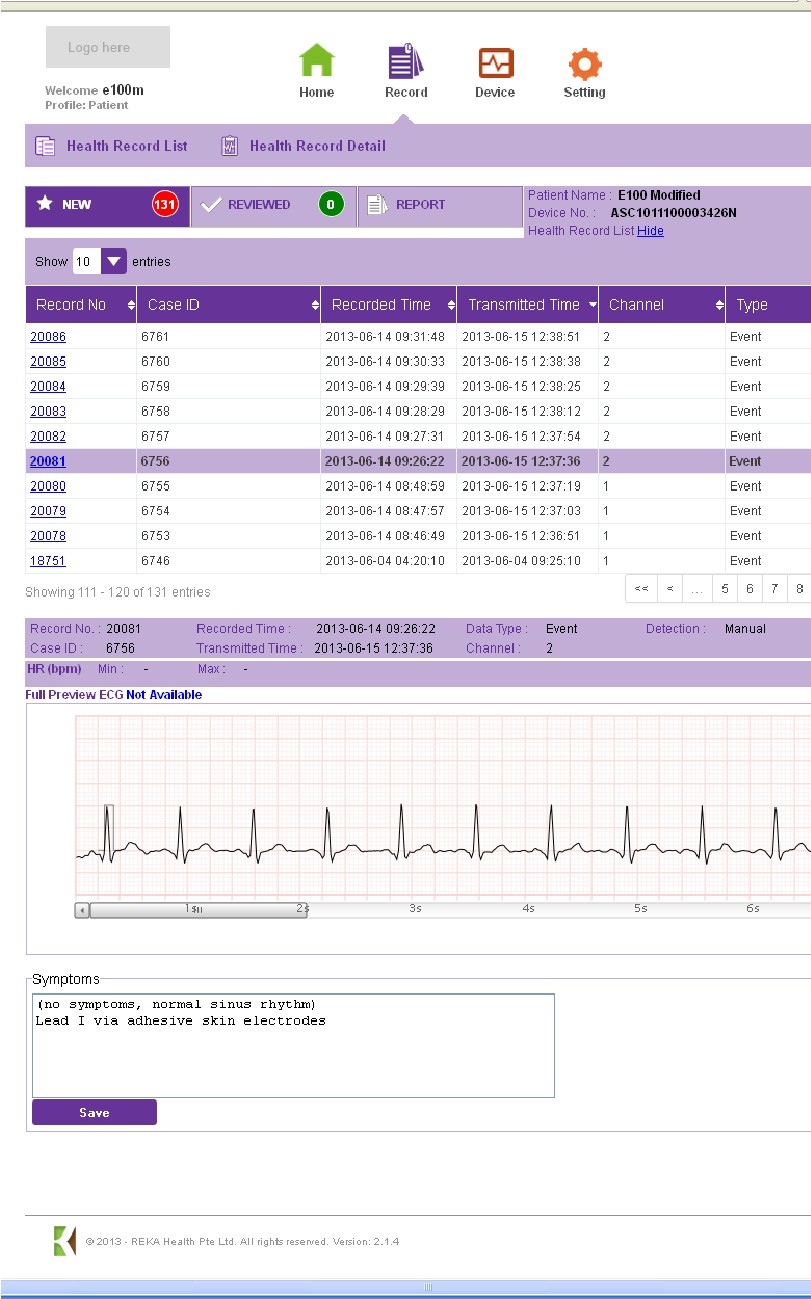 Comparison Of Handheld 1-lead ECG/EKG Recorders